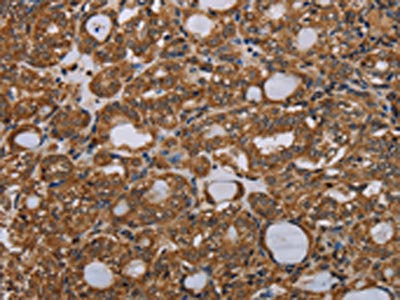 PARP8 Antibody