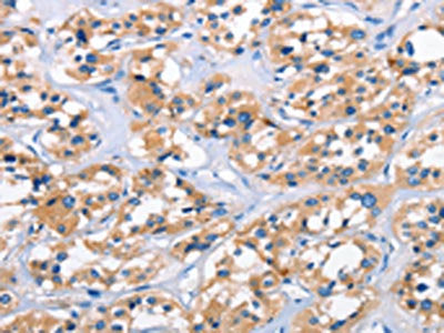 APOL6 Antibody