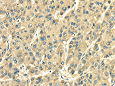 SDF4 Antibody