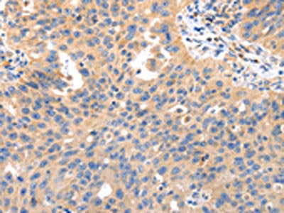 IRS2 Antibody