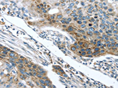 TMPRSS5 Antibody