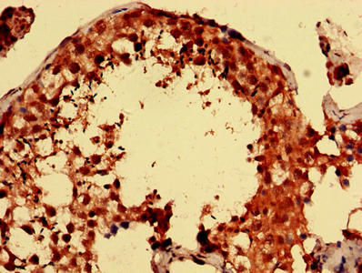 PARK7 Antibody