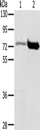 PIAS1 Antibody