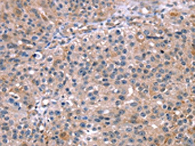 MAPK3 Antibody