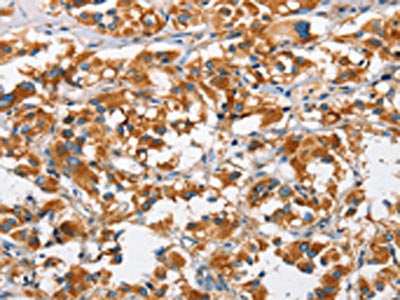 DKK3 Antibody