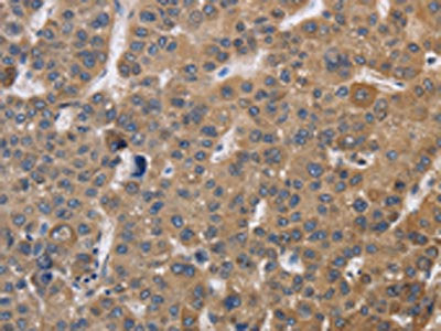 SDCCAG3 Antibody