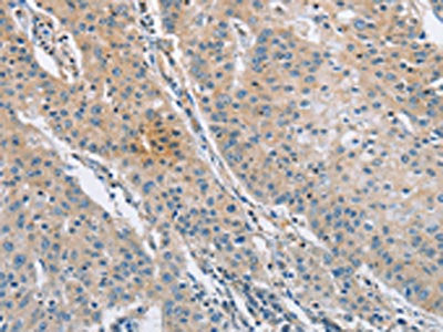 SH3GLB1 Antibody