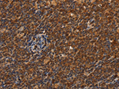 CDC34 Antibody