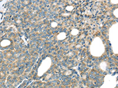 THSD1 Antibody