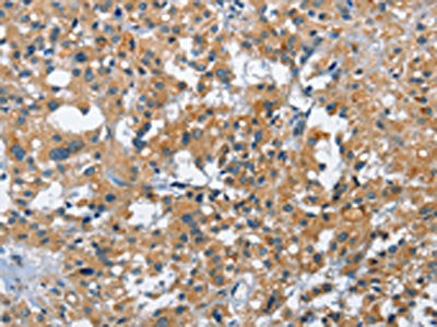 ATF4 Antibody