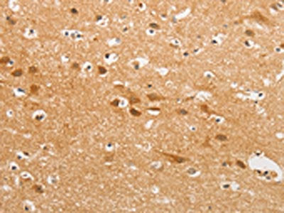 CDH6 Antibody
