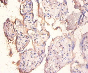 PPP1R11 Antibody