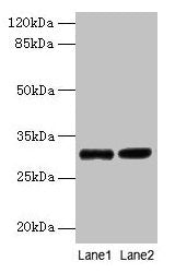 UQCRQ Antibody