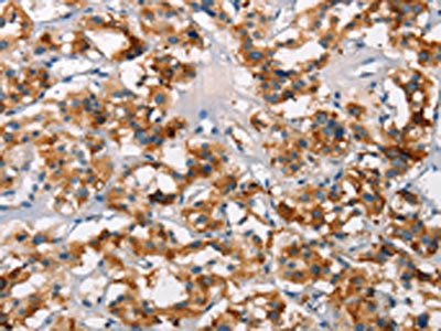 SH2B2 Antibody