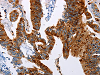 TFF3 Antibody