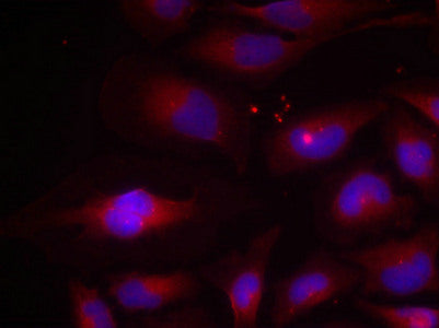 Phospho-NFKB2 (Ser870) Antibody