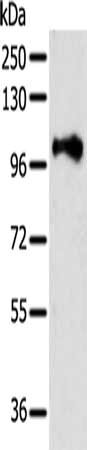 PSMD2 Antibody