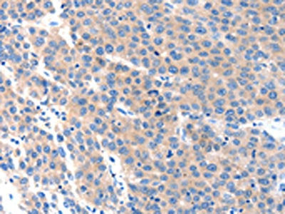 KLK2 Antibody