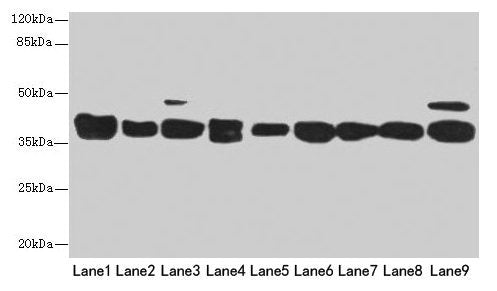 DNAJB1 Antibody