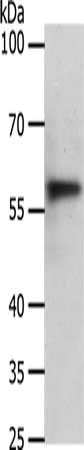 ABCD4 Antibody