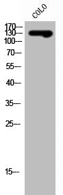 SLC4A8/SLC4A10 Antibody