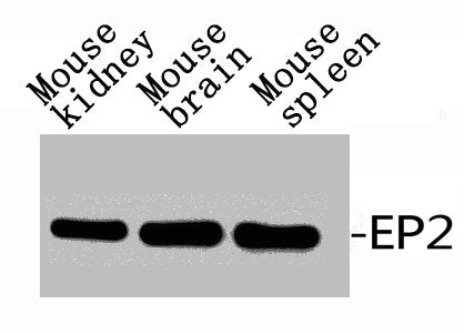 PTGER2 Antibody