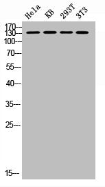 Phospho-PTK2 (S843) Antibody
