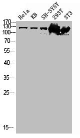 PTK2 Antibody