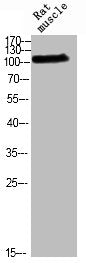 Phospho-RB1 (T826) Antibody