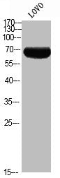 Phospho-RPS6KB1 (T444) Antibody