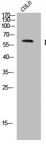 Phospho-RPS6KB1 (S371) Antibody