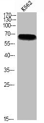 Phospho-RPS6KB1 (S427) Antibody
