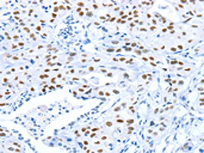 ARID1A Antibody