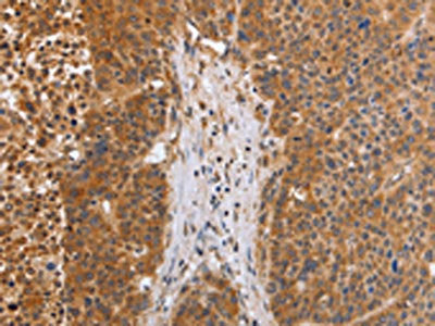 EGLN3 Antibody