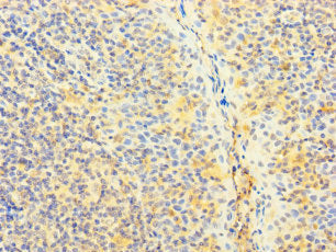 SNX22 Antibody