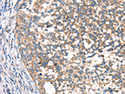 DECR1 Antibody
