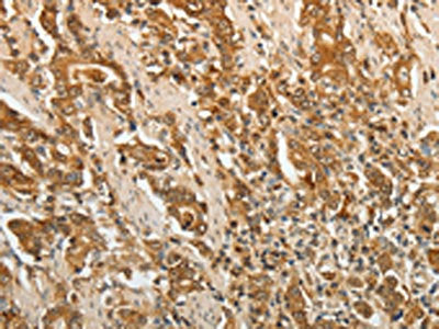 F3 Antibody