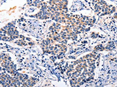 RAB39A Antibody