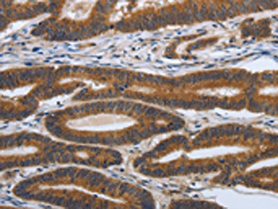 PDGFA Antibody
