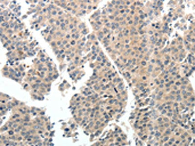 TEK Antibody