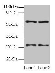 SARS Antibody