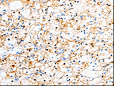 TTR Antibody