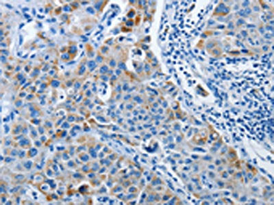 PRKG2 Antibody