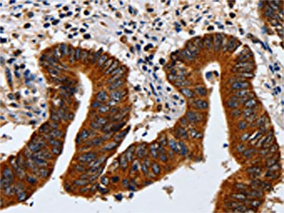 KRT23 Antibody
