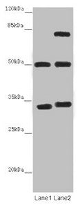 TUBA1B Antibody