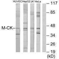 CKM Antibody