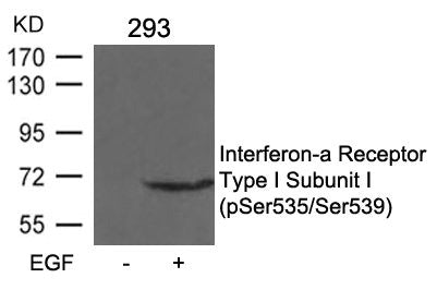Phospho-IFNAR1 (Ser535/Ser539) Antibody