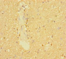 SLC6A7 Antibody