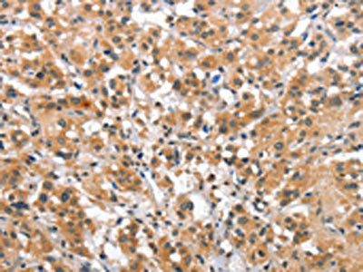 SMAD1 Antibody