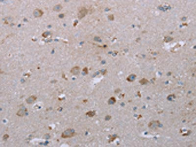 LIMK1 Antibody